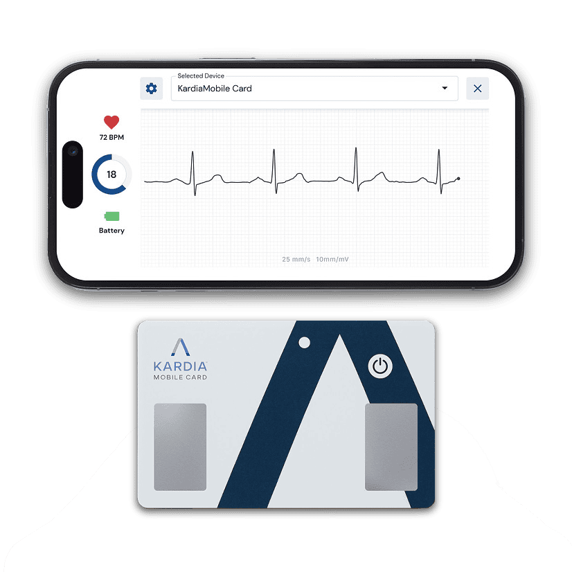 kardiamobilecard ekg device
